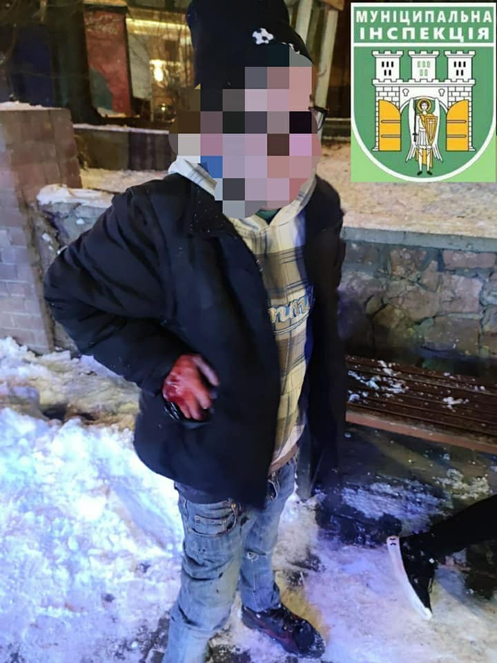 У Франківську чоловіка вкусив товариш, муніципали викликали швидку обидвом 1