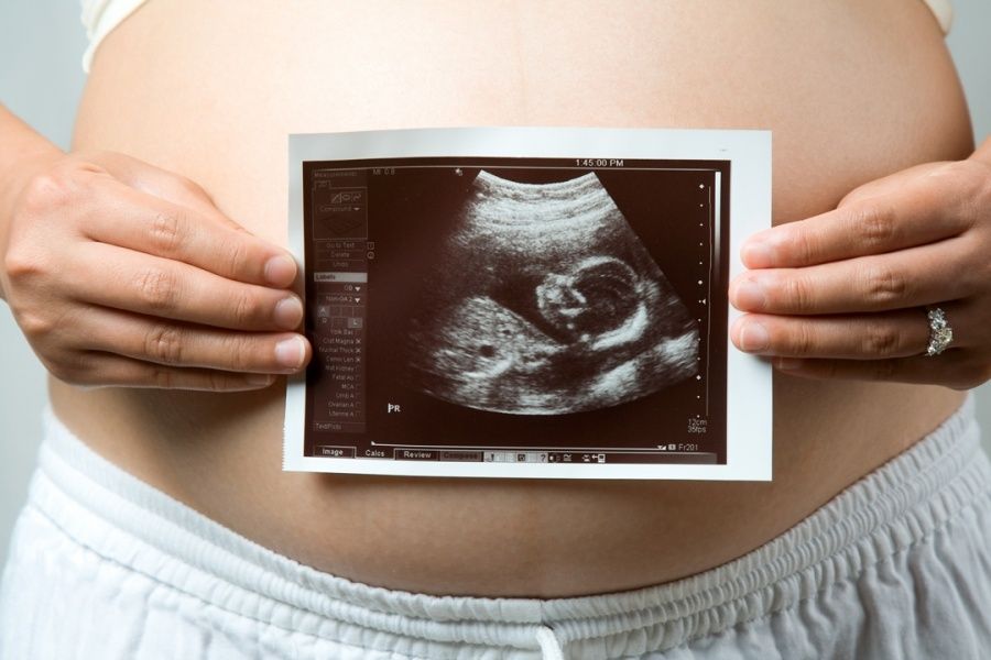 Особливості скринінгу першого триместру вагітності 1
