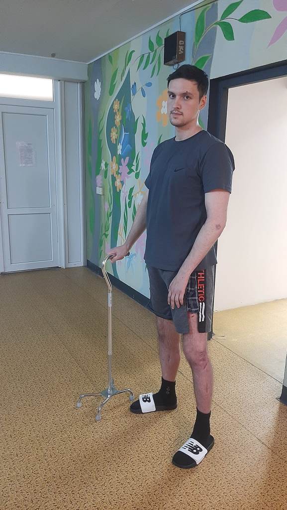 Медики розповіли історію реабілітації воїна з Івано-Франківська Мар'яна Данилюка, який переніс 12 операцій 1