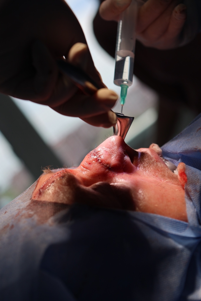 В ОКЛ втретє проведуть безоплатні пластичні операції на обличчі та шиї 2