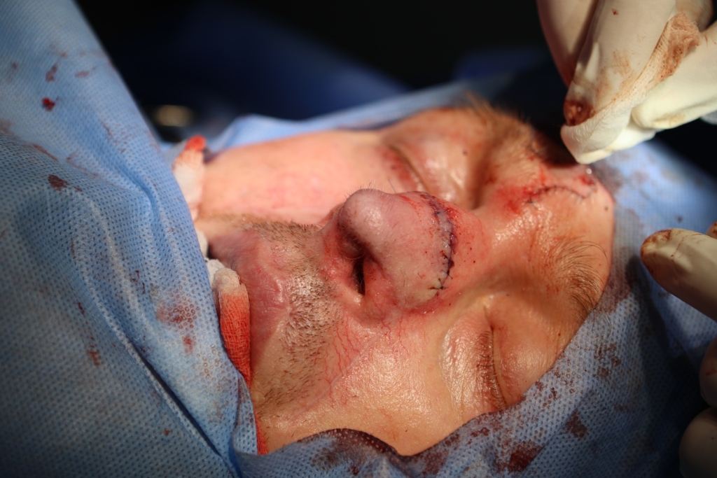 В ОКЛ втретє проведуть безоплатні пластичні операції на обличчі та шиї 4