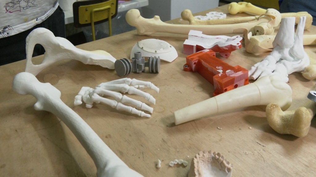 У Франківську за технологією 3D-друку розробили протез для військового, який втратив долоню 2