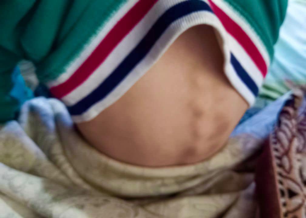 Матір побила 6-річного сина металевим предметом