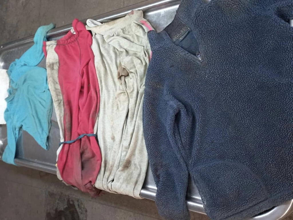 Поліцейські просять упізнати померлого, якого збило авто на об'їзній Коломиї 1