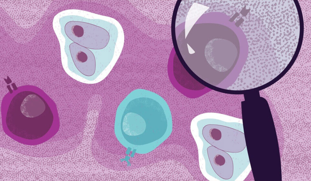 лікування неходжкінської лімфоми