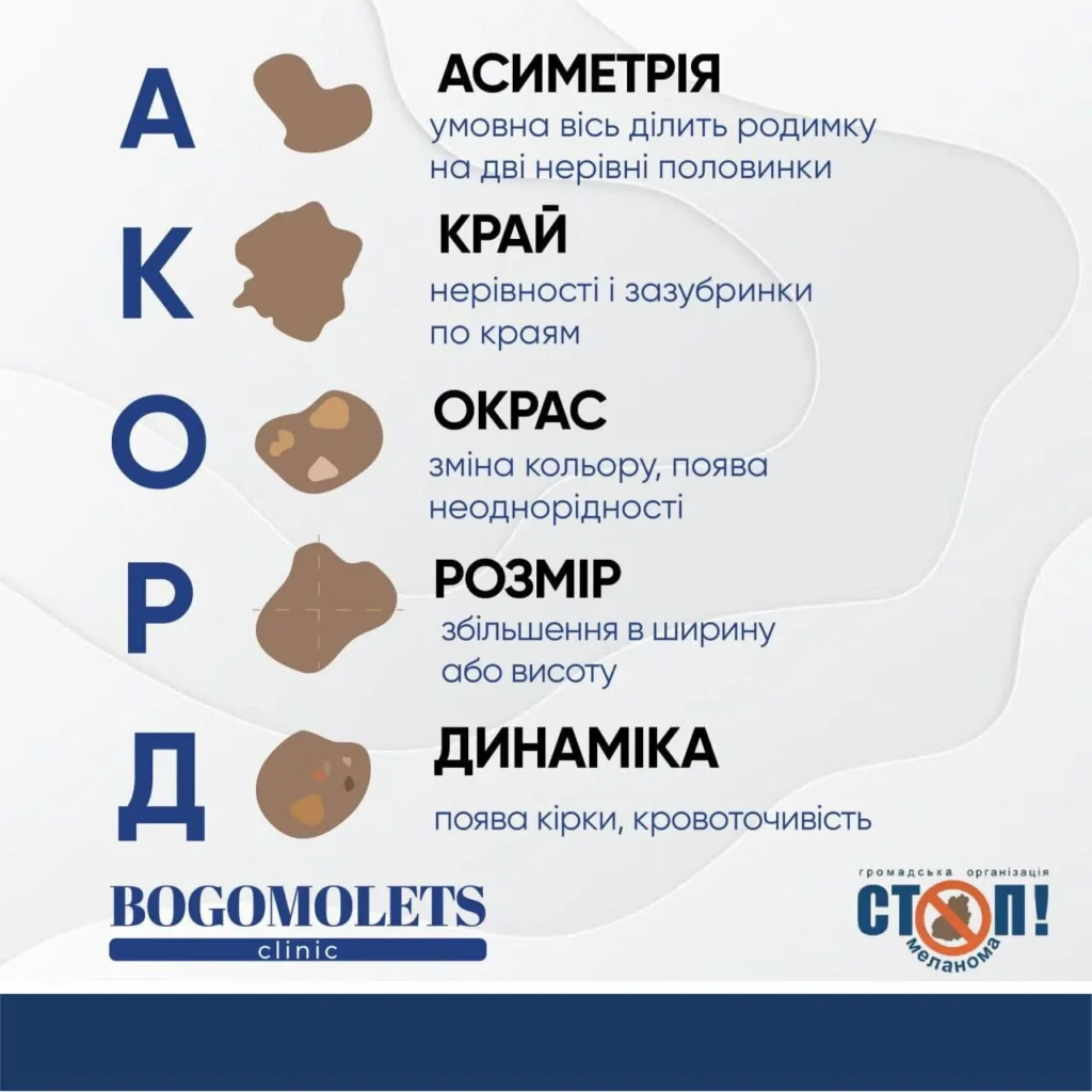 Меланома та інші шкірні новоутворення - коли звертатися до дерматолога 2