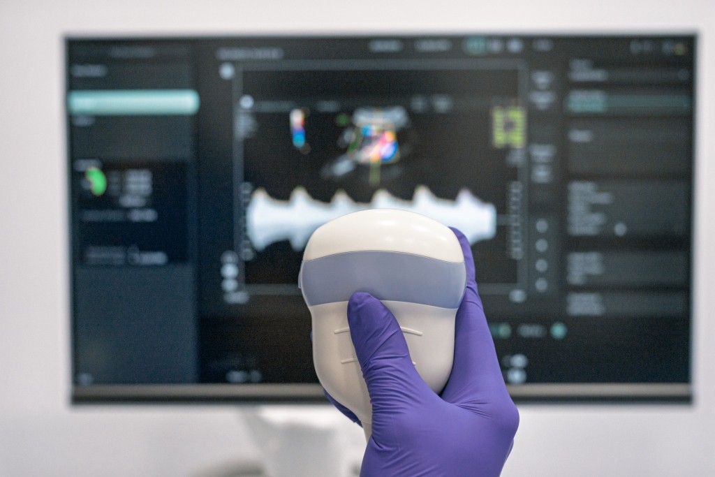 "Дзвонять татусям в окопи показати серцебиття крихітки", – лікарка УЗД про ранню діагностику вагітності 1