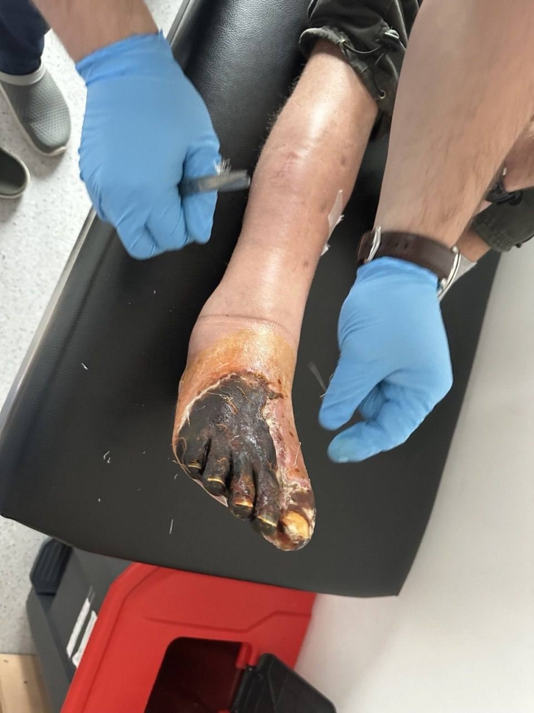 У Франківській ОКЛ врятували ногу військовому 1