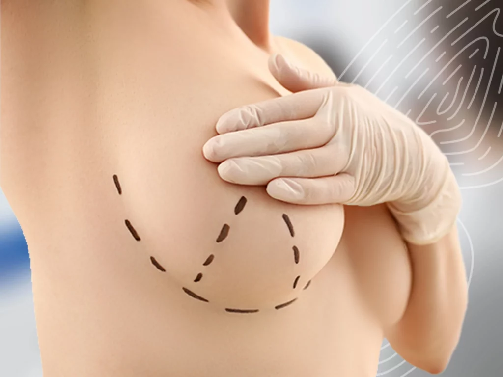 Коли можна купатися в басейні чи морі після мастектомії?