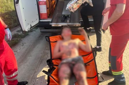 У Львові 13-річного хлопця вдарило струмом, коли він робив селфі на вагоні потяга